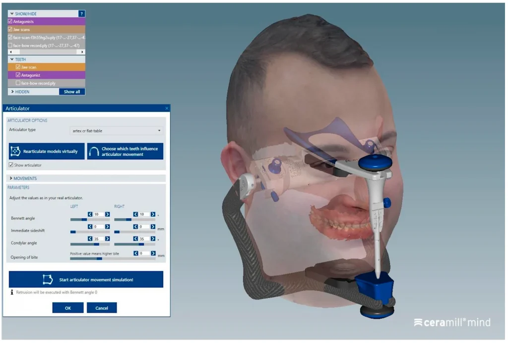 SAM артикулятор