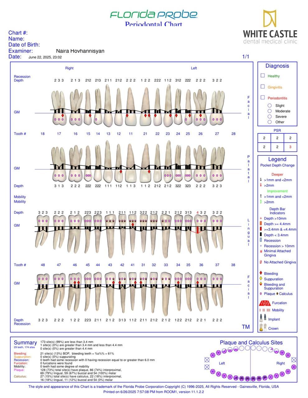 Florida Probe periodontal chart from White Castle dental clinic