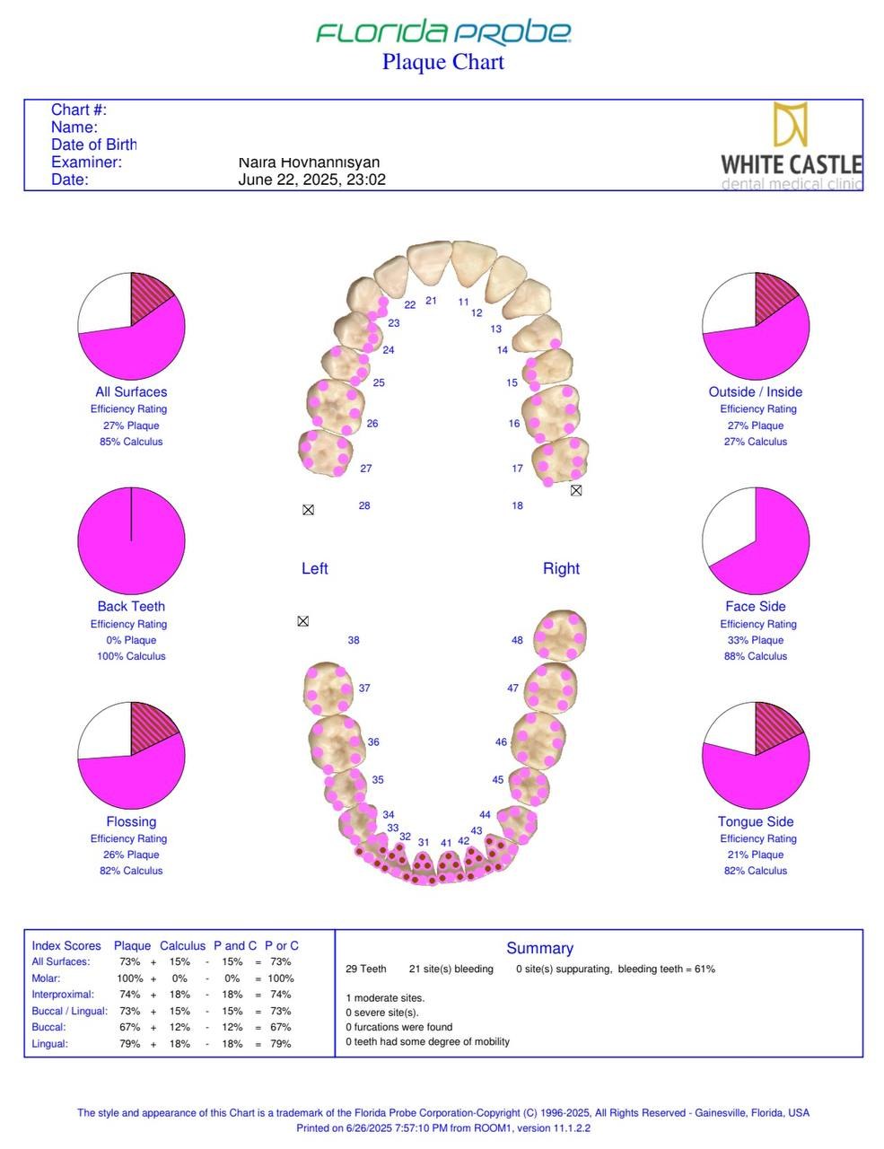 Florida Probe plaque chart showing plaque distribution by surface